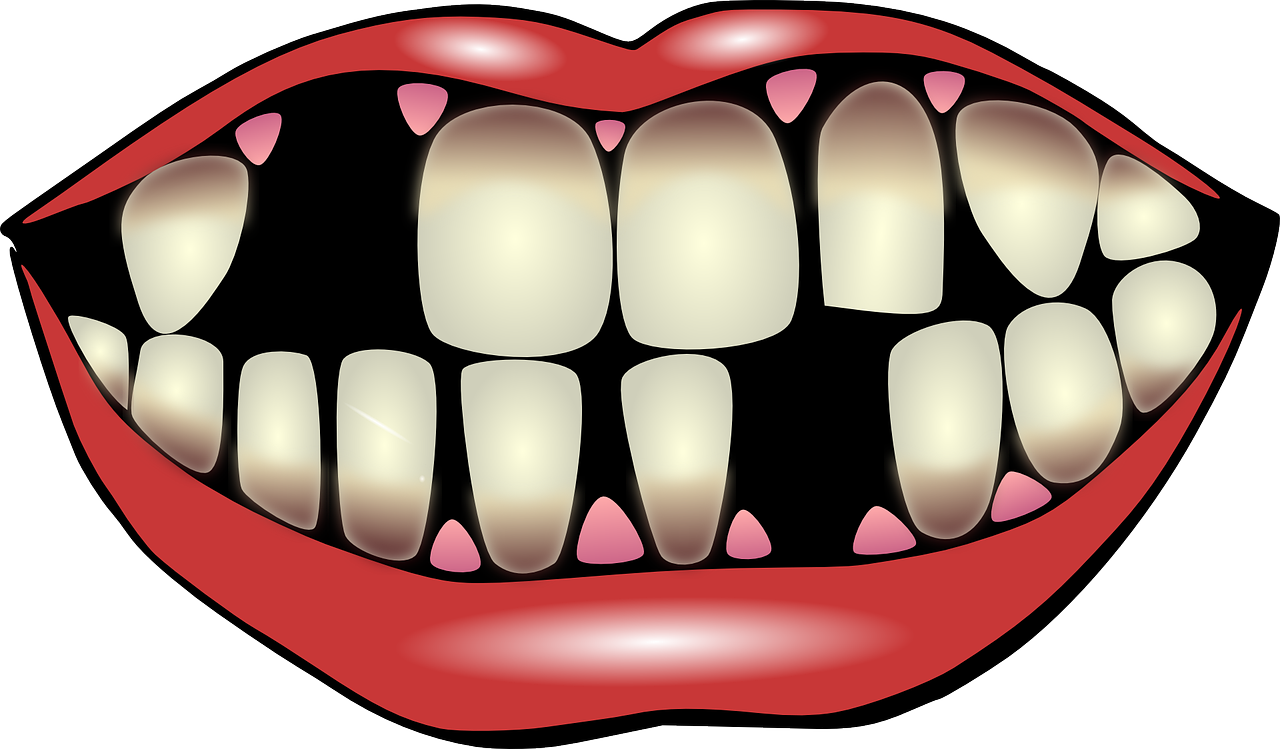 dental hygiene, dental care, falling out of teeth-156103.jpg